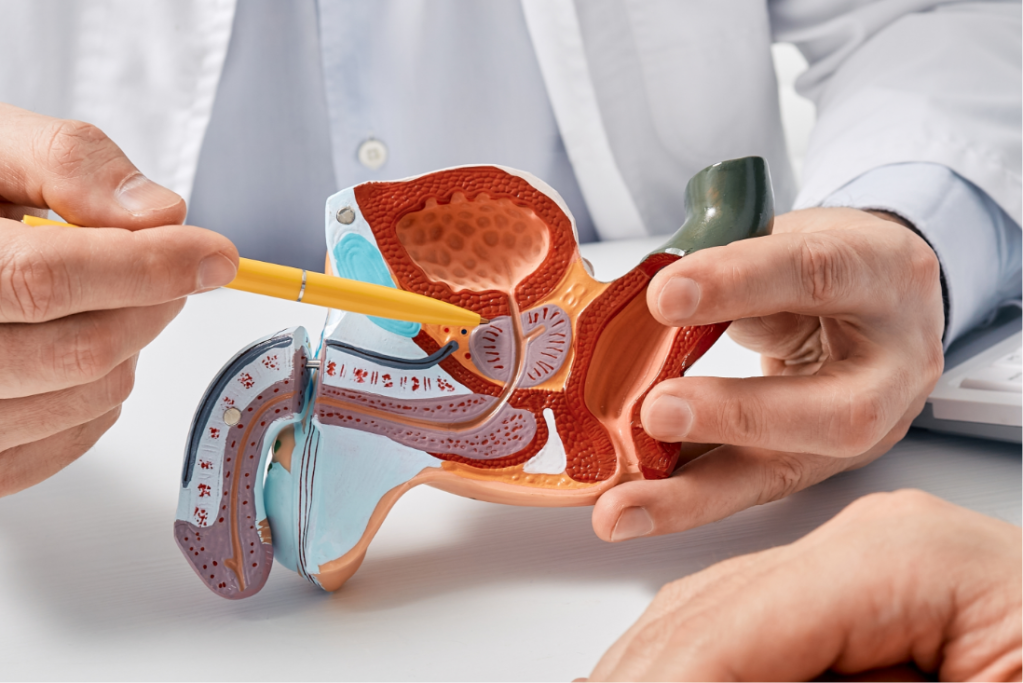 Câncer de Próstata